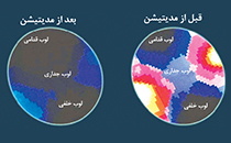 در مدیتیشن (مراقبه) چه اتفاقی برای مغز می‌افتد؟